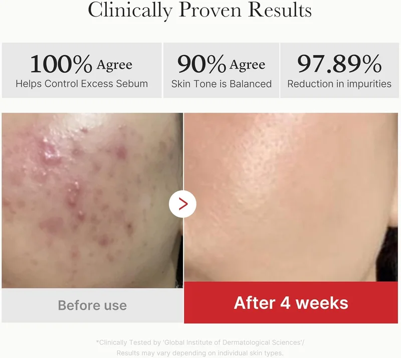 Medicube  Medicube Red Succinic Acid Panthenol Facial Peeling Pads - Exfoliating Toner Pads for Breakout-Prone Skin with Niacinamide, AHA, BHA, and Soothing Panthenol - Non-Comedogenic for Women | Best Price UAE